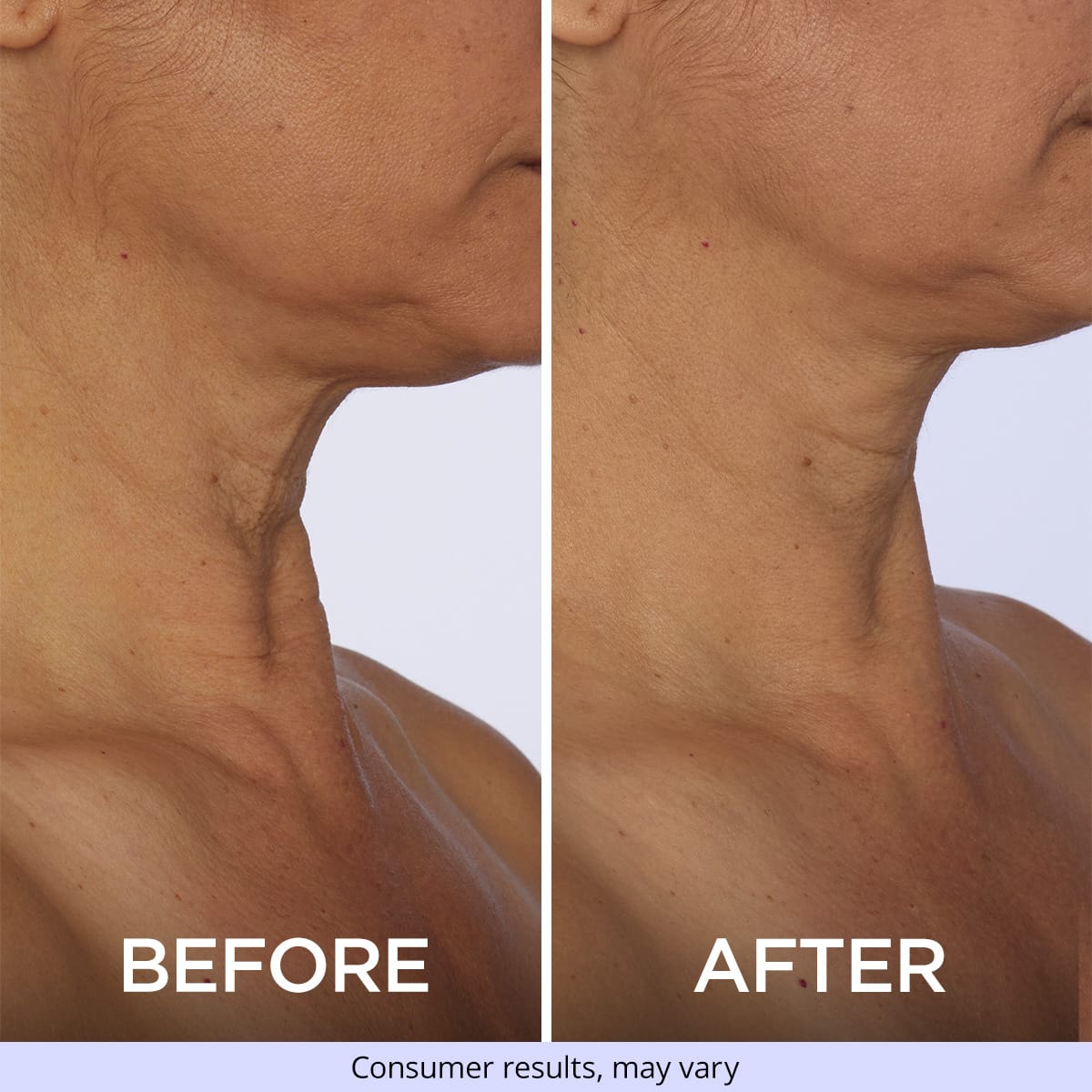 Tighten & Lift Neck Cream