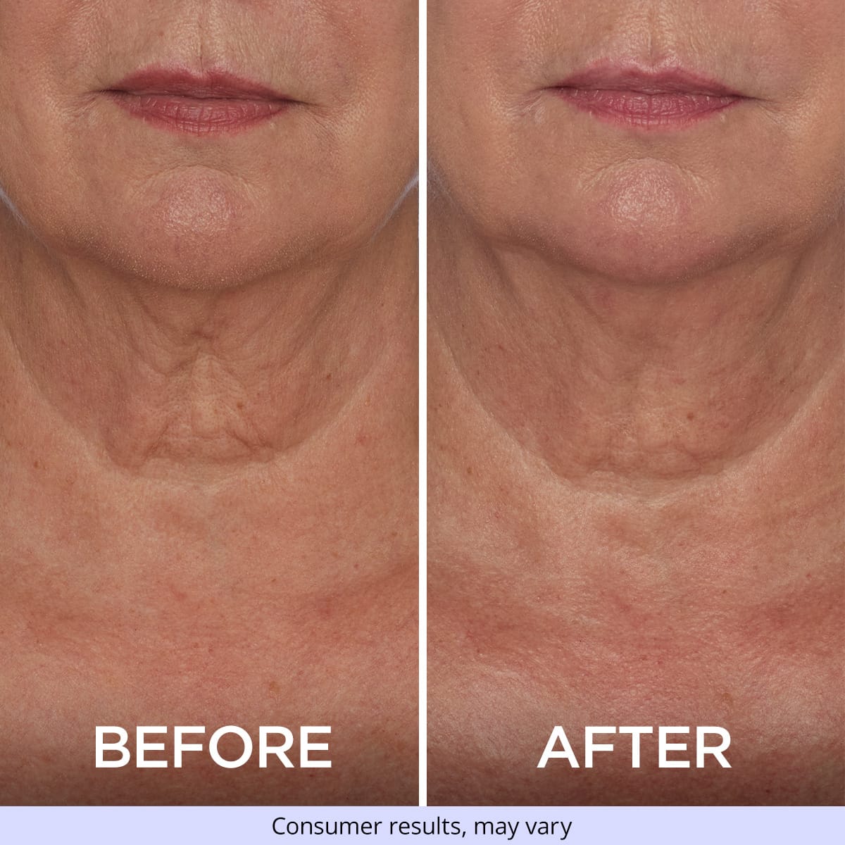 Tighten & Lift Neck Cream